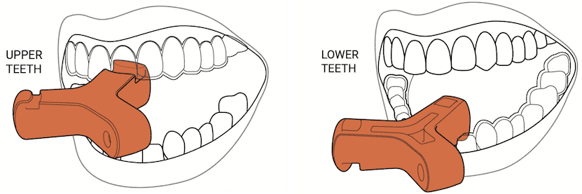 Upper and lower teeth line drawings: Two line drawings showing how to place and use Munchies® on the upper and lower teeth