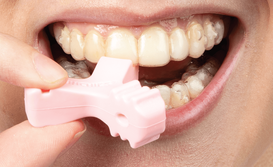 Side, close-up view of Pink Munchies® EPS engaged with upper central incisor