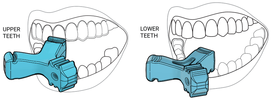 Upper and lower teeth line drawings: Two line drawings showing how to place and use Munchies® EPS on the upper and lower teeth